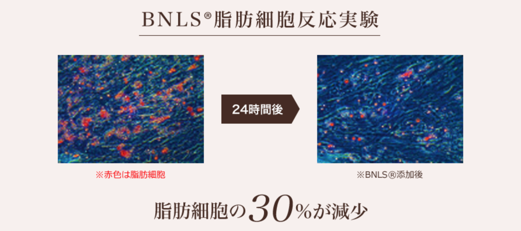 表参道スキンクリニックBNLS脂肪溶解注射の効果画像を公式サイトにて公開